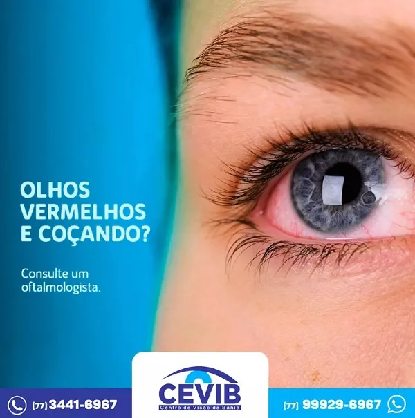 Cevib: Olhos vermelhos e coçando podem ser causados por diversas condições