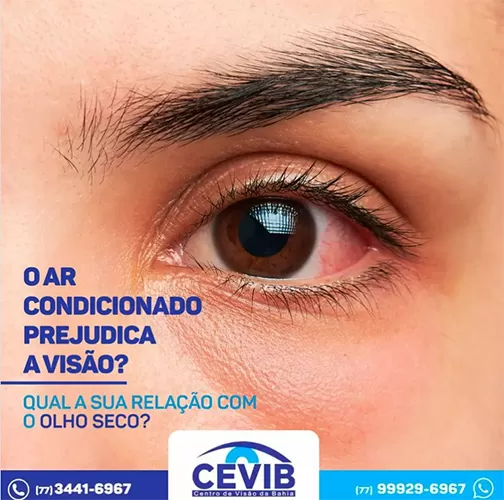 Cevib: Aparelhos de ar-condicionado podem causar a síndrome do olho seco