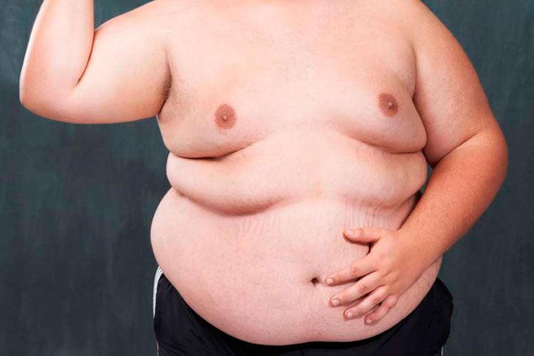 Coronavírus: Mortalidade é 10 vezes mais alta em países onde maioria é obesa, diz estudo