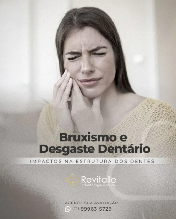 Revitalle Odontologia detalha relação entre desgaste dentário e bruxismo