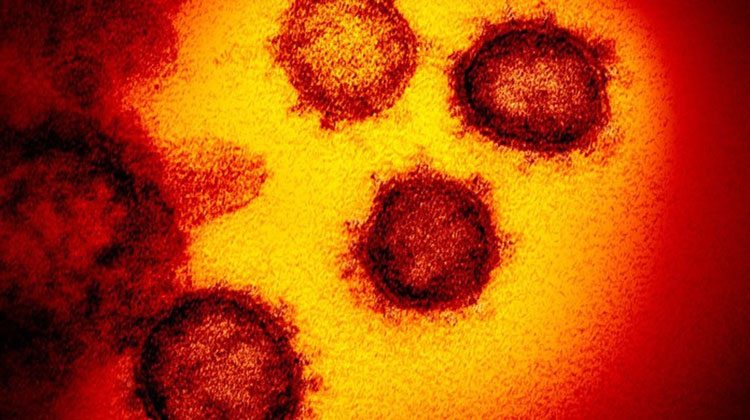 Brasil tem 9.146 mortes e 135.106 casos confirmados de novo coronavírus