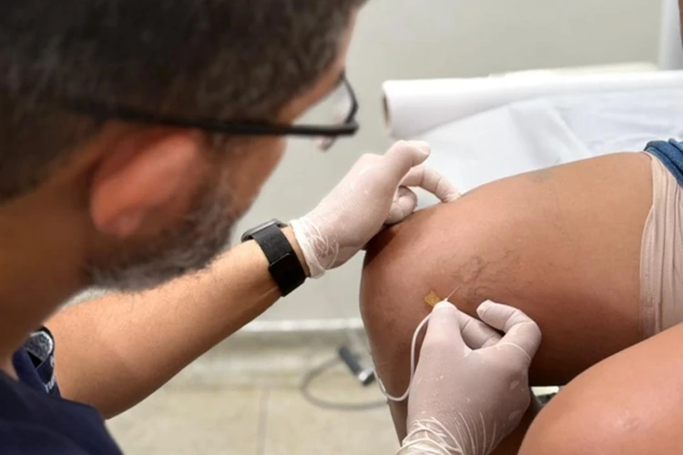 Livramento de Nossa Senhora inicia tratamento de varizes após triagem vascular