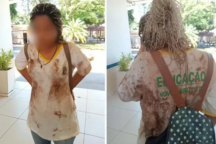 Menina de 12 anos é pisoteada e chamada de 'macaca' em escola, denuncia mãe