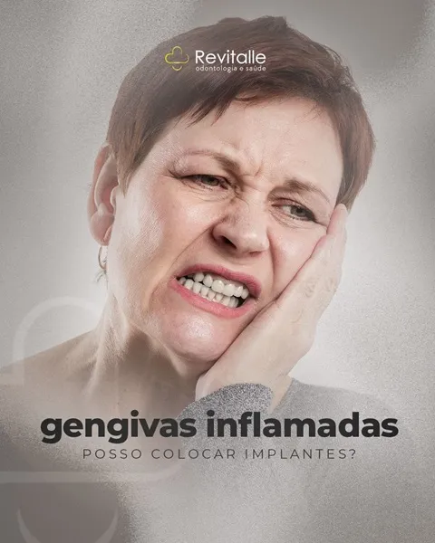 Revitalle fala sobre problemas inflamatórios nas gengivas e a instalação de implantes dentários