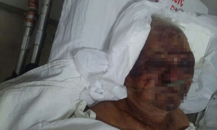 Conquista: Idoso de 80 anos é internado em estado grave após levar pedradas em assalto