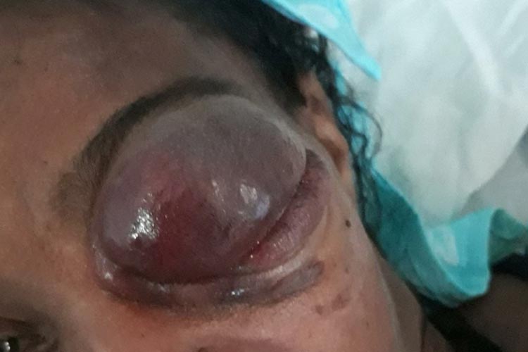 Guanambi: Mulher aguarda há quase 30 dias vaga com oncologista