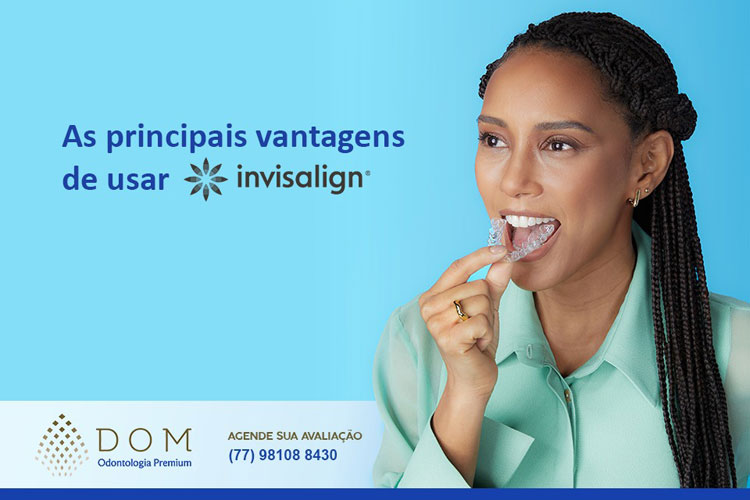 Dom Odontologia Premium: As principais vantagens de usar invisalign