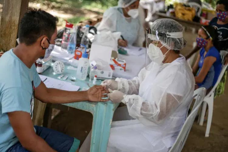 Covid-19: Pela 1ª vez, Brasil tem 6 estados em retração da pandemia
