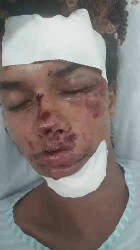 Influenciador digital é agredido e fica com rosto desfigurado em Ruy Barbosa