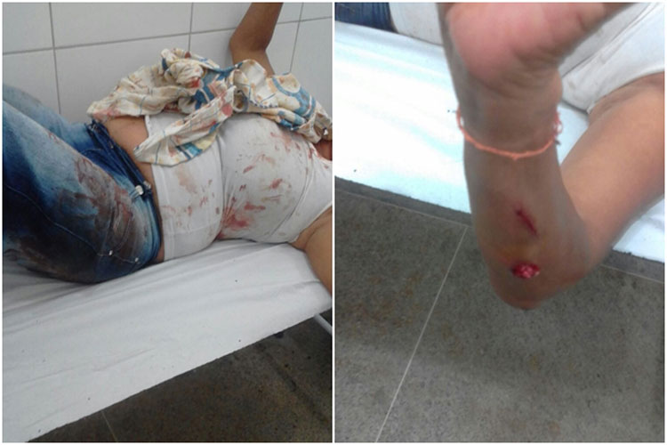 Sobrinho que agrediu a tia com golpes de facão foi preso pela Polícia Militar em Brumado