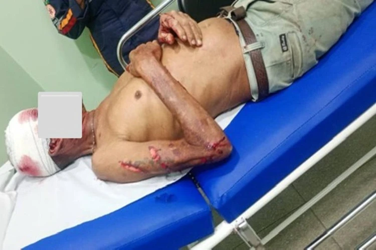 Palmas de Monte Alto: Homem entre em luta corporal e agride cunhado com barra de ferro