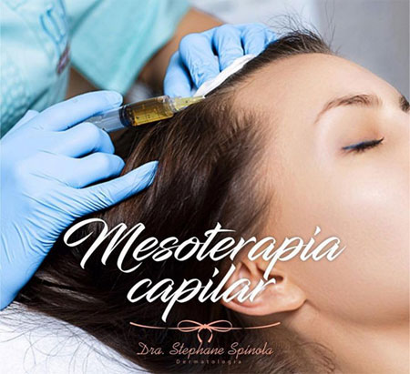 Clínica Mais Vida: Mesoterapia capilar