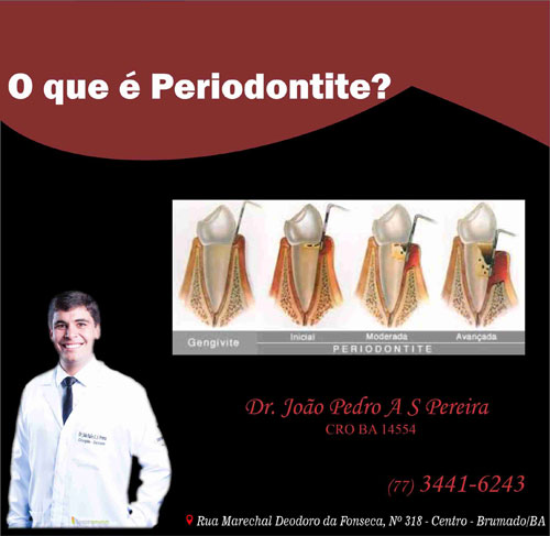 Dr. João Pedro Amorim: O que é periodontite?