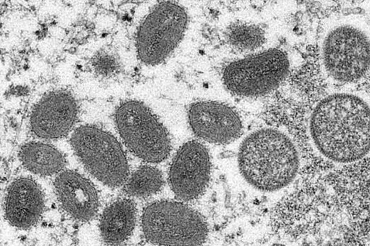 Ministério da Saúde confirma 1ª morte por varíola dos macacos no Brasil