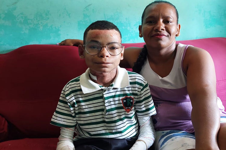 Aracatu: Com doença rara, jovem pede ajuda para comprar cadeira de rodas motorizada