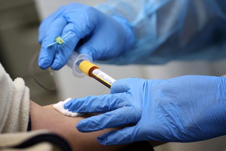 Planos de saúde terão que cobrir teste que detecta anticorpos contra o novo coronavírus