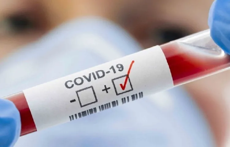 Ministério da Saúde monitora oscilação dos casos de Covid-19 no país