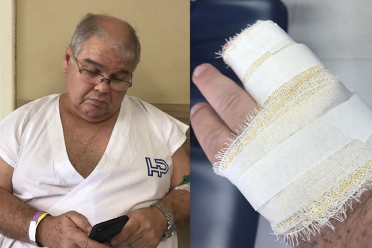 Lúcio Vieira Lima quebra costela e dedo em acidente de carro