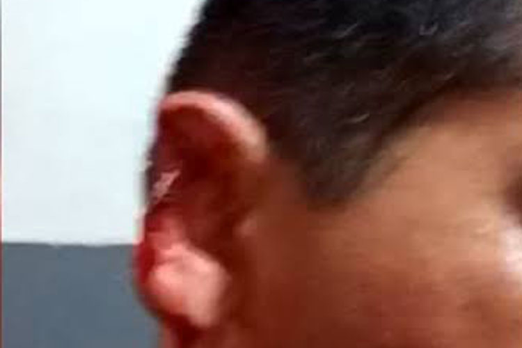 Homem tem orelha arrancada pelo filho do dono de um bar em Malhada de Pedras