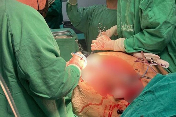 Paciente procura UPA por falta de ar e descobre tumor de 46 kg no Rio de Janeiro