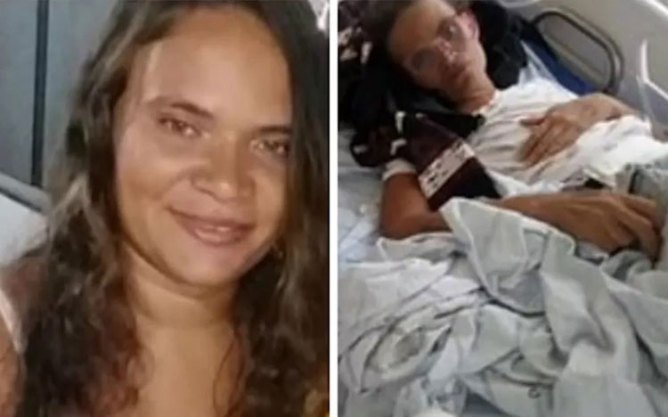 Morre mulher que teve órgãos perfurados durante procedimento médico em Juazeiro