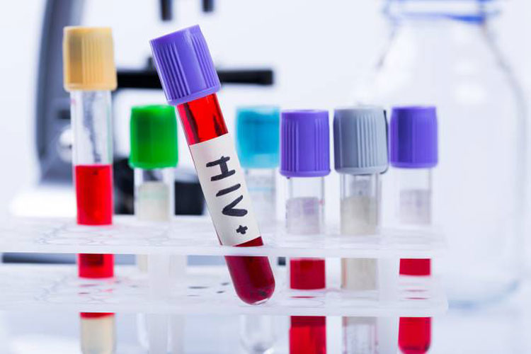 Injeção mensal para HIV pode substituir pilulas diárias no tratamento