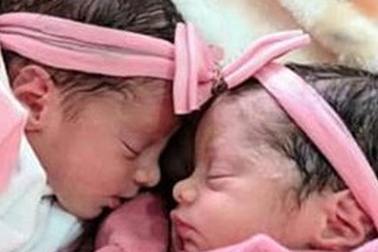 Piripá: Gêmeas recém-nascidas morrem após serem atacadas por cachorro da família
