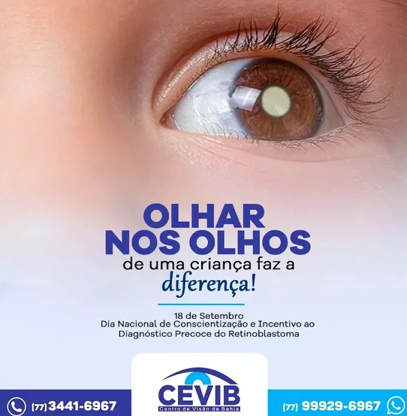 Cevib: Se descoberto precocemente, retinoblastoma tem índices de 90% de cura