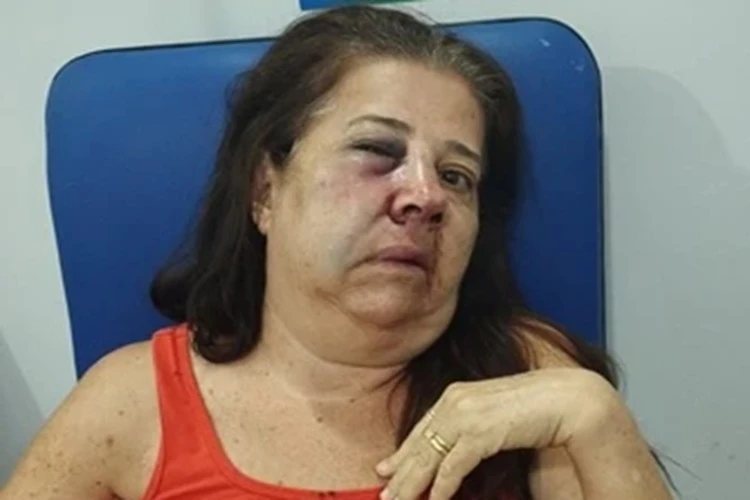 Delegado fala sobre caso da idosa brutalmente agredida na zona rural de Brumado