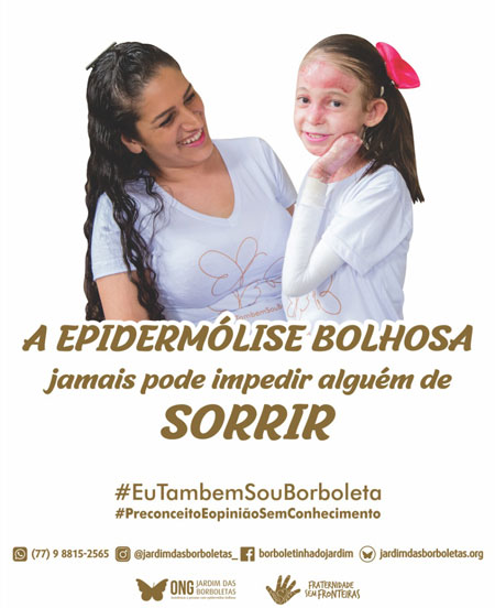 ONG Jardim das Borboletas lembra que outubro é o mês da conscientização da Epidermólise Bolhosa