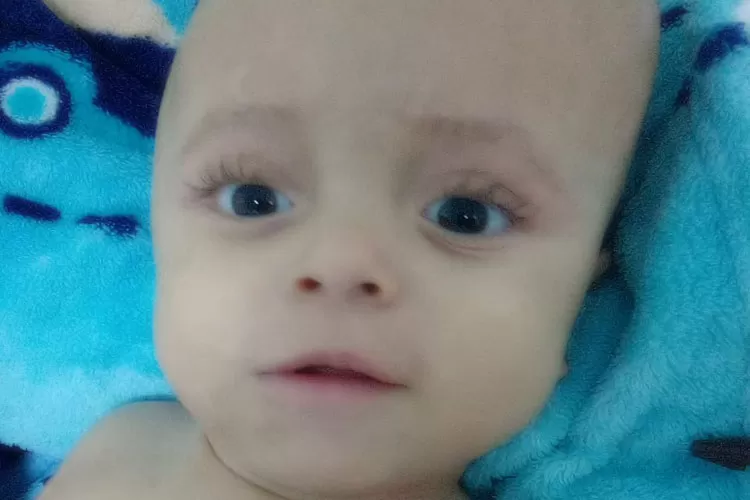 Brumado: Após passar por 25 cirurgias e luta contra a hidrocefalia, morre Bryan Loran, 2 anos