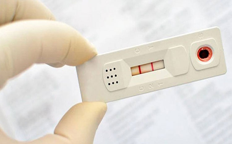 Covid-19: Farmácias registram aumento de 326% em testes positivos