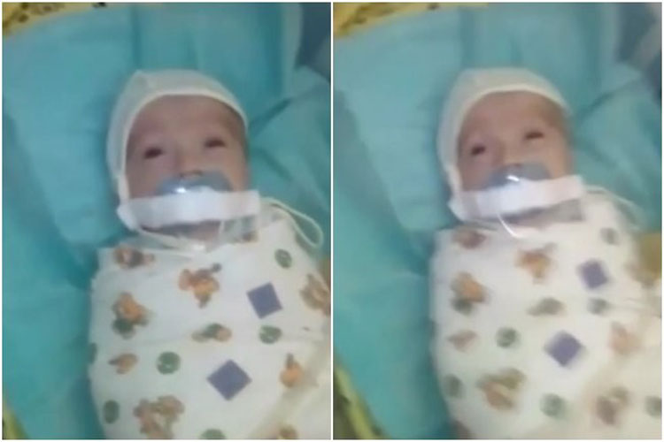 Vídeo de bebê com chupeta presa na boca causa revolta na web
