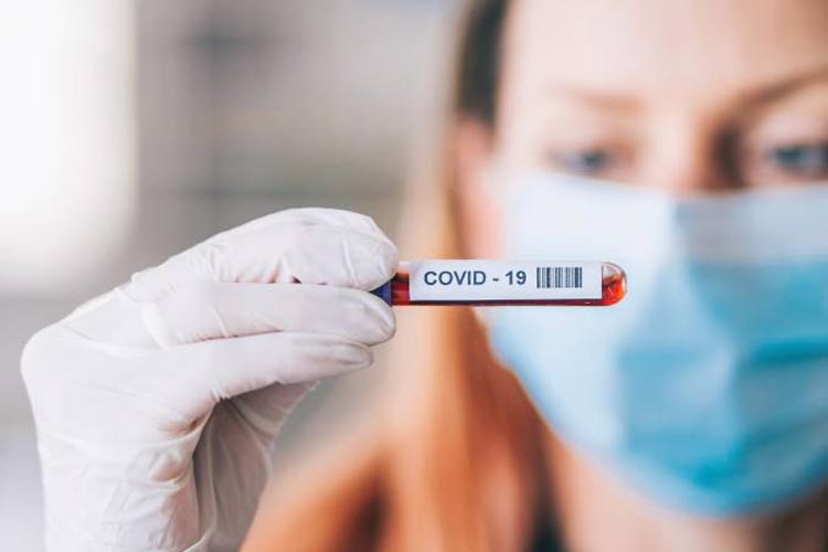 Covid-19: Pesquisa associa proteínas do sangue à gravidade da infecção
