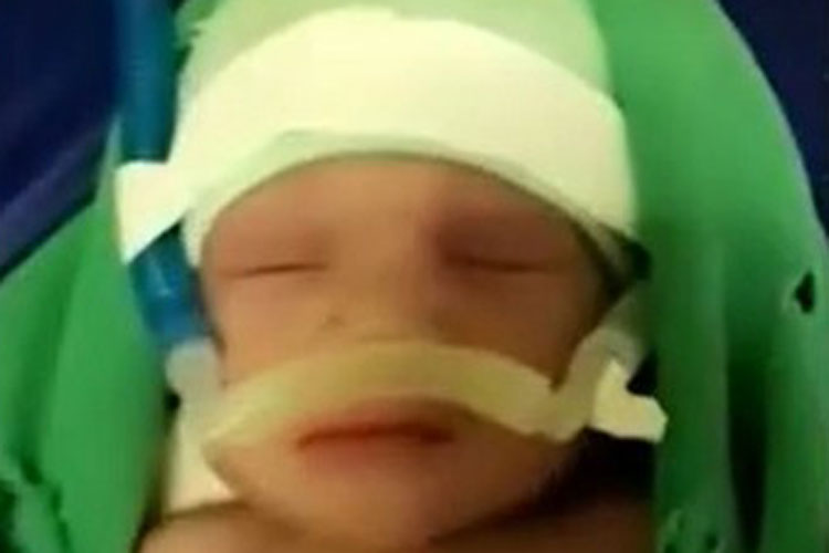 Bebê com malformação do cérebro aguarda transferência urgente para UTI em Vitória da Conquista