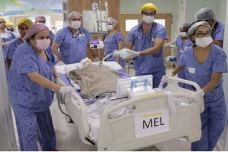 Após cirurgia de 20 horas, gêmeas ligadas pelo crânio são separadas em Brasília