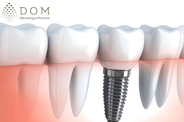 O melhor tratamento dentário é na Dom Odontologia Premium em Brumado