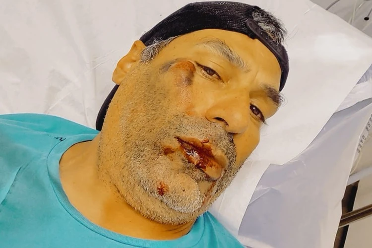 Agente de trânsito de Brumado fica ferido após acidente de bicicleta