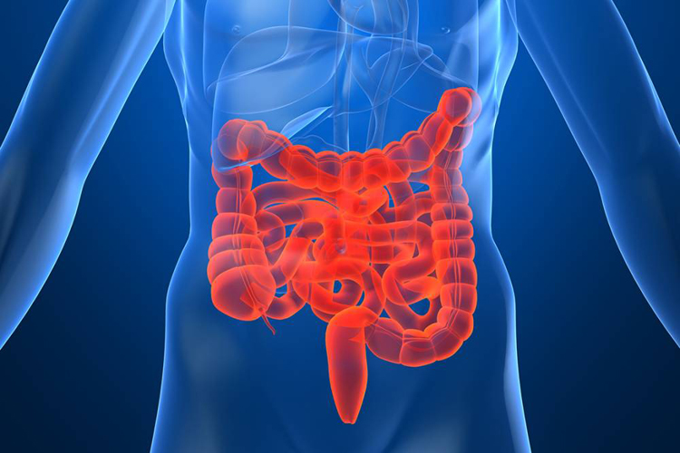 Câncer intestinal poderá ser detectado por uma gota de sangue
