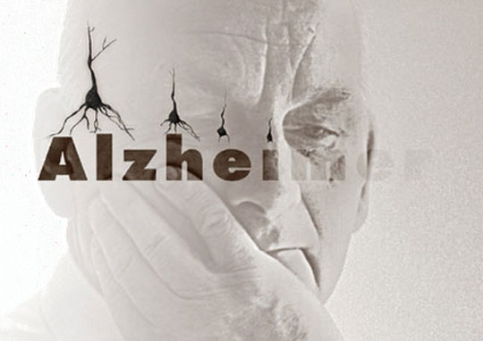 Paraíba: Cirurgia de Alzheimer freia evolução do mal e recupera memória