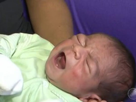 Bebê nasce com 2 dentes e assusta a mãe em Eunápolis
