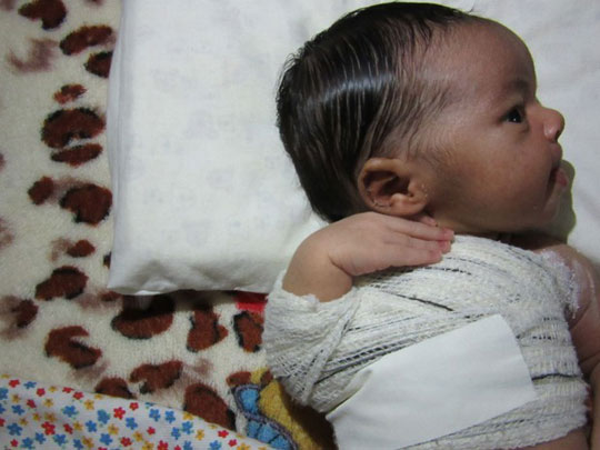 Bebê tem braço fraturado no parto e pai denuncia violência médica no Distrito Federal
