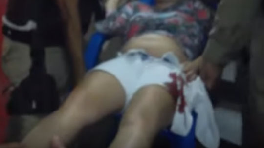 Brumadense é atingida com disparo de arma de fogo em Itabuna