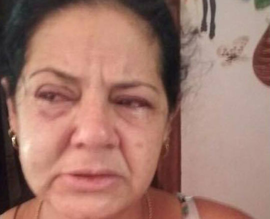 Caetité: Homem em surto psicótico agride mulher e tenta colocar fogo em sua casa