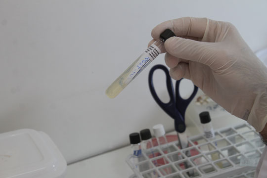 Caso suspeito de H1N1 mobiliza área da saúde em Brumado
