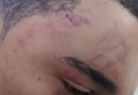 Brumado: Fotógrafo briga com lutador de MMA e sai desmaiado após receber golpe de capacete