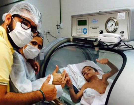 Gêmeo siamês que sobreviveu a cirurgia sai de UTI para ir a clínica
