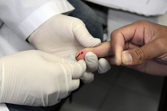 Tratamento revolucionário será oferecido a pacientes com hepatite C na rede pública
