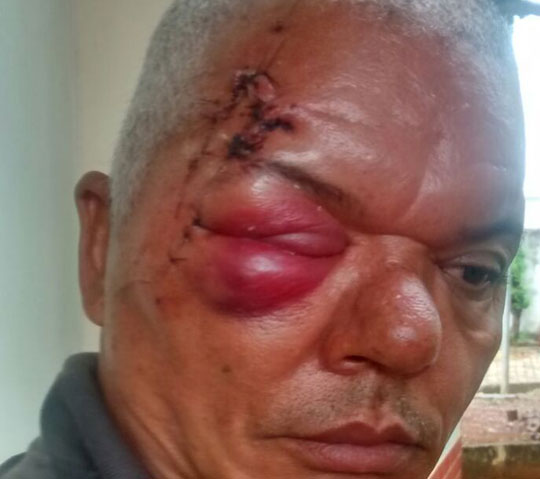 Brumado: Família pede justiça após homem ter sido brutalmente agredido durante discussão