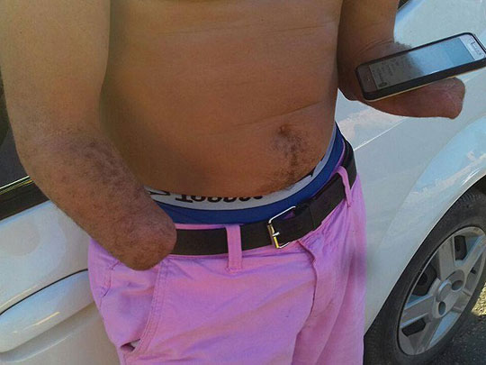 Com mãos amputadas, homem é flagrado ao dirigir em Santo Antônio de Jesus